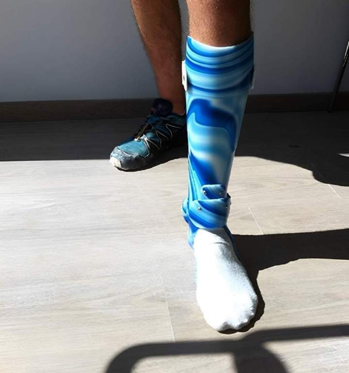 Nous fabriquons des prothèses adaptés à votre morphologie. 