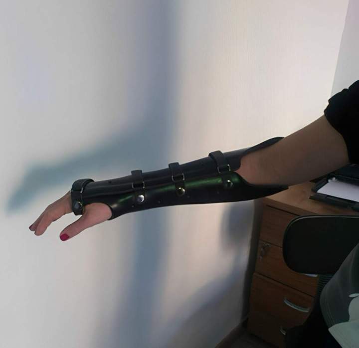 Nous pouvons fabriquer des orthèses qui allient résistance et durabilité. 