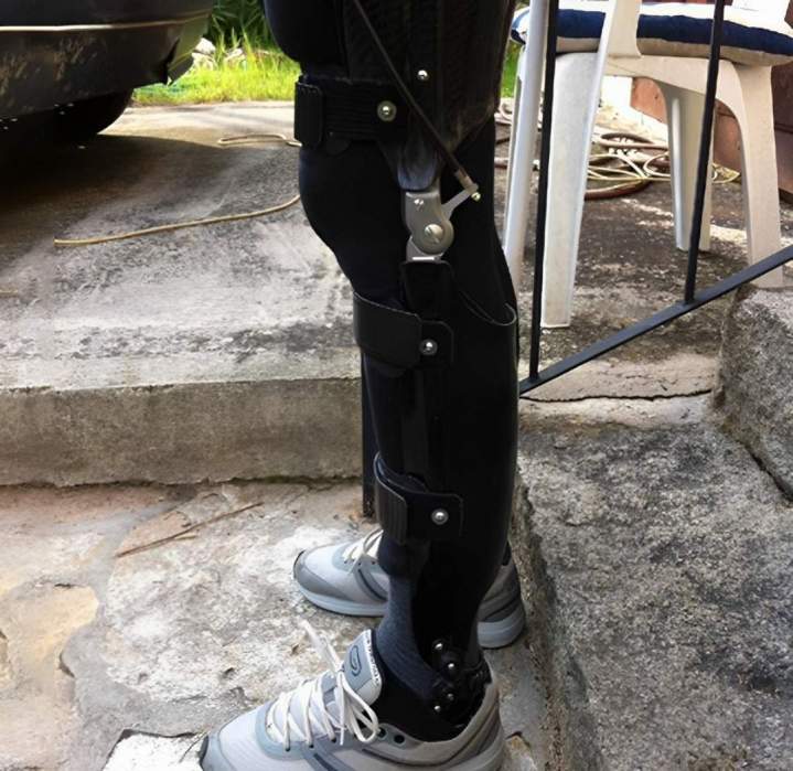 Nous sommes vos spécialistes en appareillage prothétique. 